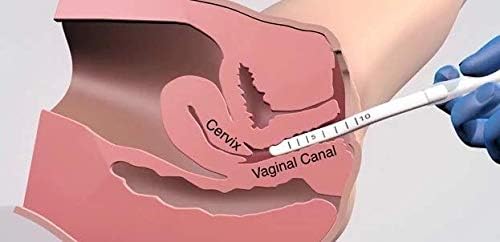 Vaginal Tightening Rejuvenation Device