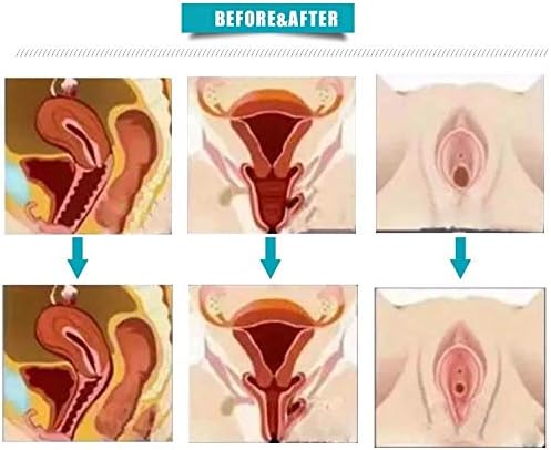 Vaginal Tightening Rejuvenation Device