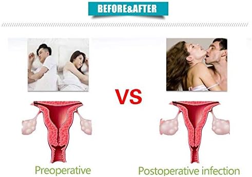 Vaginal Tightening Rejuvenation Device