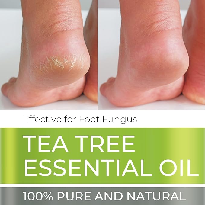 Tea Tree Essential Oil - Huge 4 FL OZ - 100% Pure & Natural – Premium Natural Oil with Glass Dropper (Tea Tree) - Bloomnest