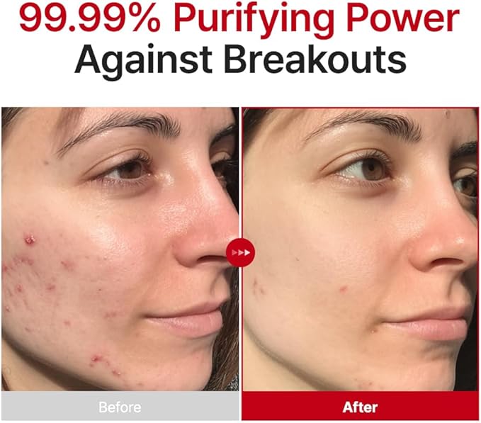 PURITO Hypochlorous Acid Facial Spray | Witch Hazel 5% + Forest Breeze | HOCl Facial Mist for Sensitive, Redness-Prone Skin | Refreshing Toner Mist | Korean Skincare, 100mL / 3.38 fl.oz - Bloomnest