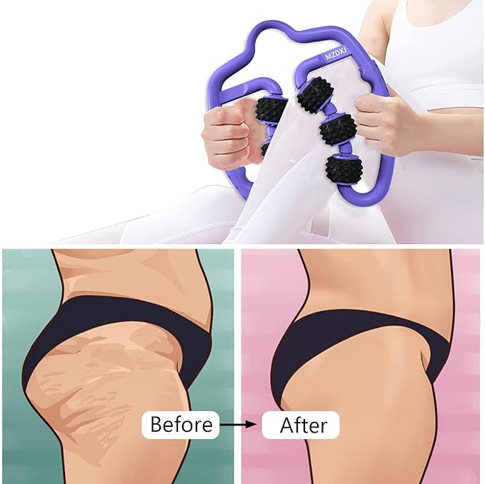 Cellulite Massage Tool Muscle Roller - Deep Fascia Massager & Dimpled Skin Remover for Legs, Thighs & Buttocks - Anti-Cellulite Roller, Smooth Skin, Pain Reliefs (Purple Black - 6 Wheel) - Bloomnest