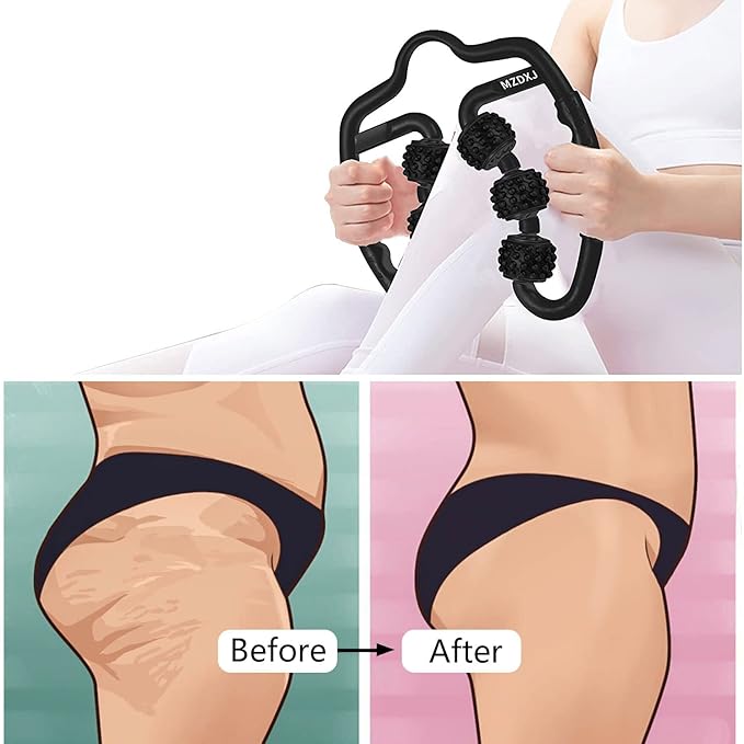 Cellulite Massage Tool Muscle Roller - Deep Fascia Massager & Dimpled Skin Remover for Legs, Thighs & Buttocks - Anti-Cellulite Roller, Smooth Skin, Pain Relief（Black - 6 Wheel） - Bloomnest