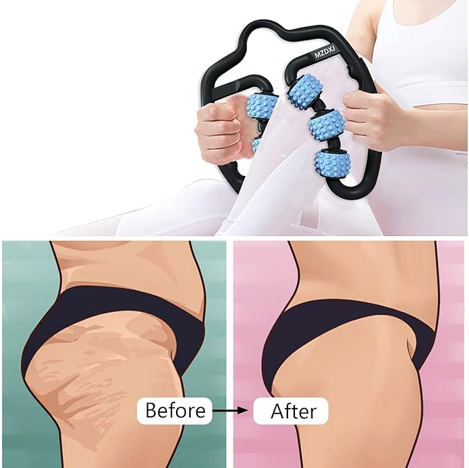 Cellulite Massage Tool Muscle Roller - Deep Fascia Massager & Dimpled Skin Remover for Legs, Thighs & Buttocks - Anti-Cellulite Roller, Smooth Skin, Pain Reliefs(Black Blue - 6 Wheel) - Bloomnest