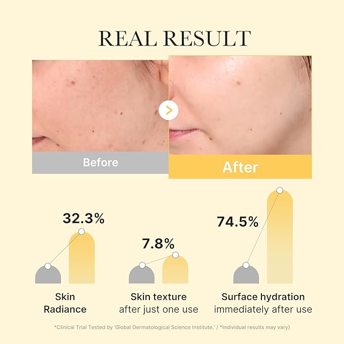 medicube Jelly Gel Mask with Brightening Kojic Acid Turmeric | Overnight Face Mask for Glass Glow Skin | Elasticity, Hydrating, Firming and Radiance Boosting | Korean Skincare, 28g x 4ea - Bloomnest
