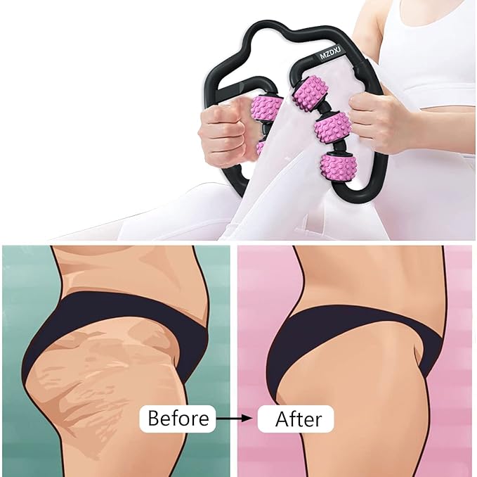 Cellulite Massage Tool Muscle Roller - Deep Fascia Massager & Dimpled Skin Remover for Legs, Thighs & Buttocks - Anti-Cellulite Roller, Smooth Skin, Pain Reliefs (Black Pink -6Wheel) - Bloomnest