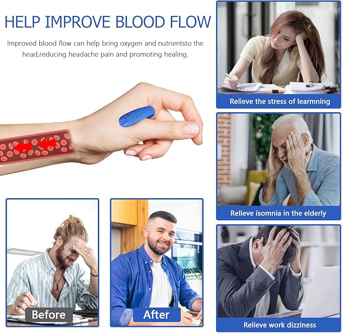 8 Pcs Acupressure Hand Pressure Point Migraine Clip, Palm Magnet Massage, Tension Relief Wearable – Supporting Acupressure Relaxation, Relief Clip Headache Pressure Point Tool for Relaxation