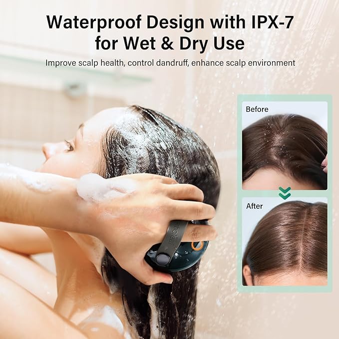 arboleaf Scalp Massager Electric, Portable Head Massager Scalp Stress Relax, Waterproof 6 in 1 Hair Massage with 8 Removable Claws, Rechargeable Hair Head Scratcher, Gifts for Her Him arboleaf