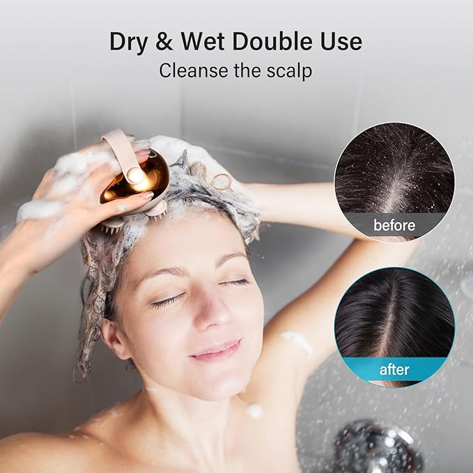 arboleaf Electric Scalp Massager Head Massager Scalp Stress Relax, 5 in 1 Kneading 128 Massage Nodes, Waterproof Hair Massage with 8 Removable Claws Cat Scratcher, Gift for Dad Mom arboleaf