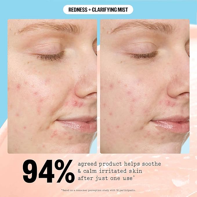 PEACE OUT Redness + Clarifying Mist, Hypochlorous Acid Facial Spray for Acne-Prone Skin, Helps Calm Redness, Control Excess Oil, and Refresh Skin Over and Under Makeup, 3.3 fl oz - Bloomnest