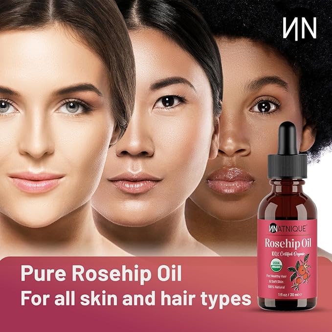 Natnique Organic Rosehip Seed Oil, 1 oz – USDA Certified Cold-Pressed Moisturizer for Face, Skin & Hair – Natural Hydrating Serum for Wrinkles & Fine Lines – Ideal for Gua Sha Massage & Radiant Glow - Bloomnest