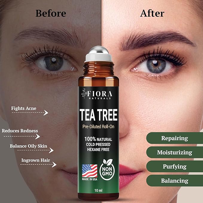 Fiora Naturals Tea Tree Oil Roll On - 100% Natural Tea Tree Essential Oil for Skin, Face, Acne, Nails, Cuticles, Scalp & Aromatherapy Wellness - Bloomnest