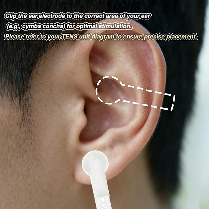 White Soft Gel Ear Clips for TENS Unit - Compatible with TENS 7000, Reusable 2mm Electrodes Bloomnest