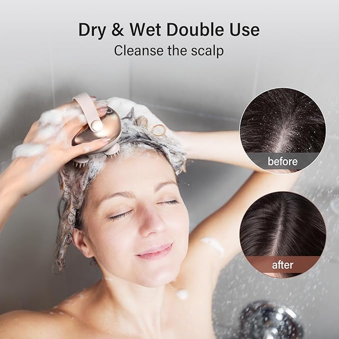 arboleaf Scalp Massager Kneading Head Massager Scalp Stress Relax Portable Rechargeable Hair Massager Shower Massage Waterproof Cat Massager Scratcher,Gift for Mom Dad arboleaf