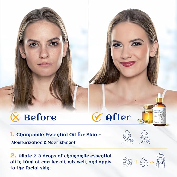 HIQILI 30ML Chamomile Essential Oil, Pure & Natural Chamomile Oil for Diffueser, Skin, Soap, Shampoo - 1.01 Fl Oz - Bloomnest