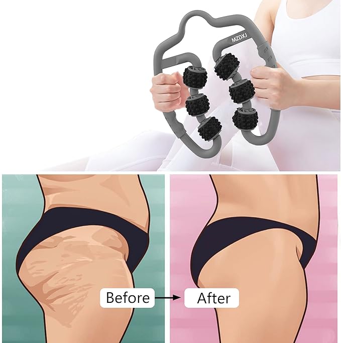 Cellulite Massage Tool Muscle Roller - Deep Fascia Massager & Dimpled Skin Remover for Legs, Thighs & Buttocks - Anti-Cellulite Roller, Smooth Skin, Pain Reliefs (Grey Black-6Wheel) - Bloomnest