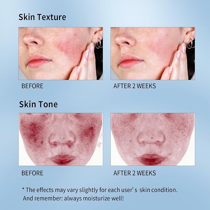 Soothing Face Sheet Mask (10 Sheets), Anti-Aging, Detoxifying & Moisturizing Face Mask for Sensitive Skin with Centella Asiatica, Vitamin B5, Glass Skin Face Mask for after Microneedling - Bloomnest