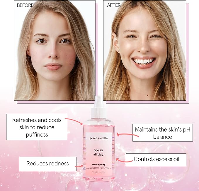 grace & stella Award Winning Rose Water Spray for Face with Glycerin & Aloe Vera - Travel Size (30ml) - Rosewater Face Mist for All Skin Types - Hydrating, Calming, Rejuvenating Facial Toner - Vegan - Bloomnest