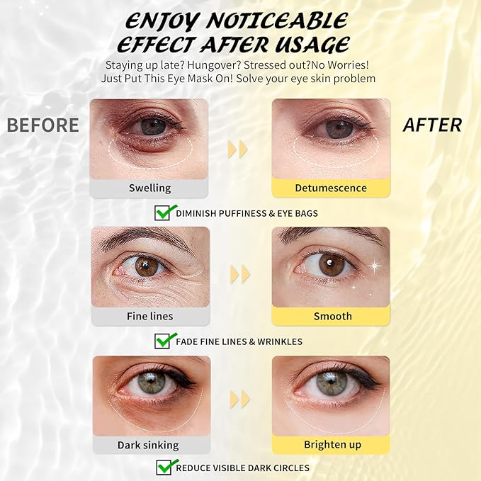 Under Eye Patches (30 Pairs), Caffeine Eye Masks for Dark Circles Puffy Eyes Undereye Bags, Collagen Eye Patches for Wrinkles and Puffiness, Skin Care Gift for Her - Bloomnest