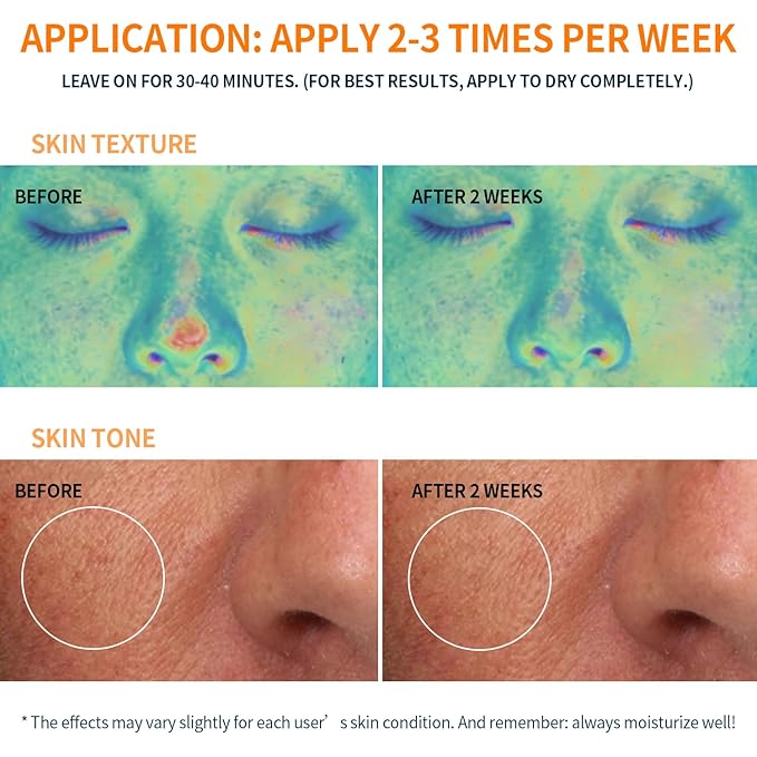Firming and Moisturizing Sheet Face Masks (Pack of 10) with Hyaluronic Acid and Peptides, Reduce Fine Lines and Wrinkles, Hydrating & Anti-Aging Spa Face Mask, Facial Skin Care - Bloomnest