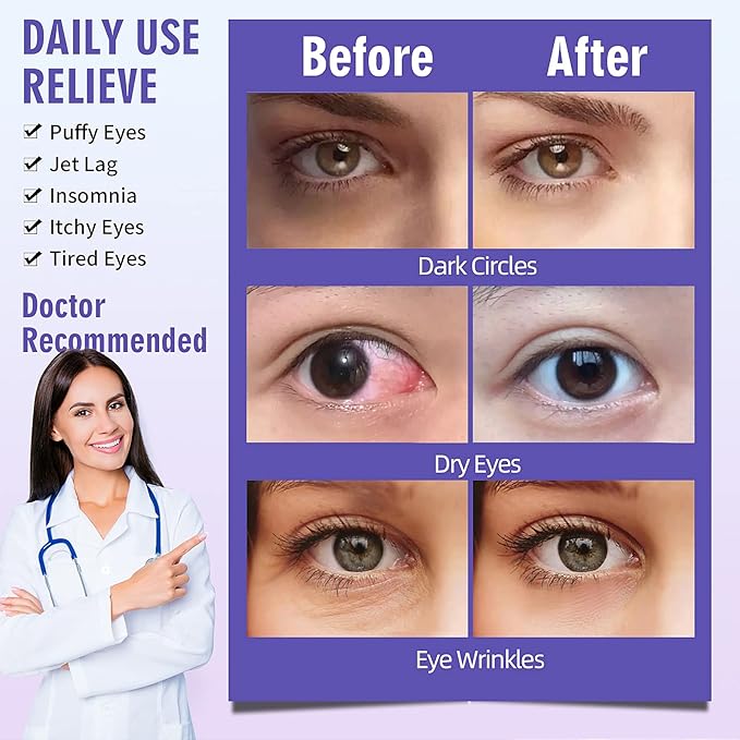 Serfeymi 10 Packs Steam Eye Masks Relieve Eye Fatigue, Hot Compress Self Heating Warm Eye Mask, Disposable Eye SPA Heated Eye Mask for Dry Eyes Dark Circles Tired Eyes -Lavender(5PCS)+ Chamomile(5PCS) - Bloomnest