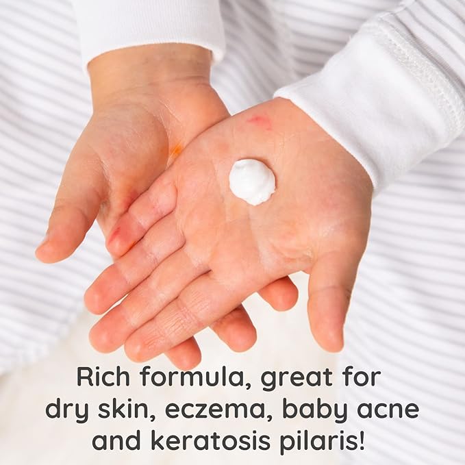 Bubbsi Whipped Coconut Oil Baby Lotion for Eczema, Dry Skin, Baby Acne, KP | Organic Coconut Oil, Shea Butter, Vitamin E | Light, Natural Scent | EU Compliant, Vegan (Refill Pouch, 32oz) - Bloomnest