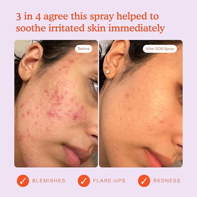 Tower 28 SOS Daily Rescue Facial Spray - Hypochlorous Acid Spray to Help Reduce Redness, Calm Irritation + Alleviate Flare-Ups - Purifying Travel Size Face Toner - Everyday Skin Care Essential (1 oz) - Bloomnest