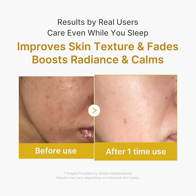 medicube Wrapping Mask Kojic Acid, Turmeric, Vitamin C Overnight Peel Off Facial Mask | Brighten & Defends Against Skin Stress for a Clear, Glowing Complexion | Korean Skin Care, 2.53 fl.oz - Bloomnest