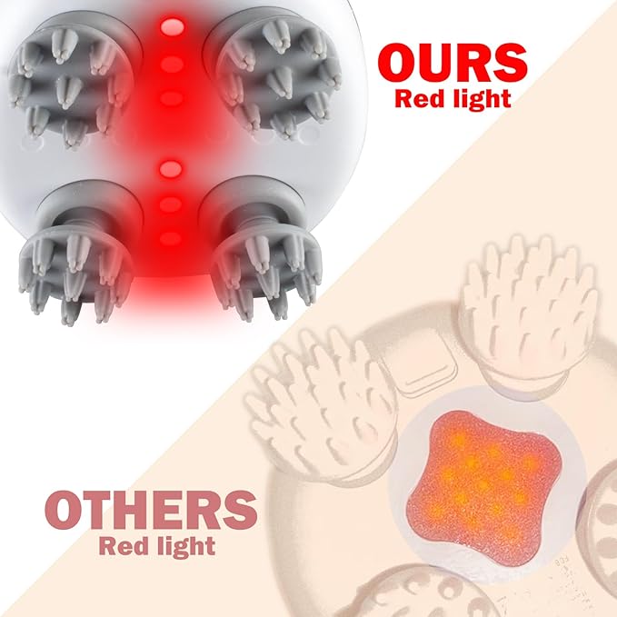 Electric Scalp Massager with red Light Therapy,Waterproof Head Massager with 108 nodes,4 Modes,Wireless Charging to Relieve deep Tissue Pressure mxm2mxm---Letlifebekindtohealthletlifeflourishandimprove