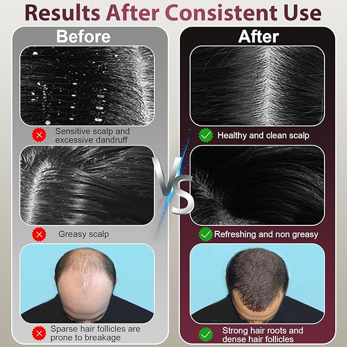 Laser Therapy Hair Growth Comb, Hair Oil Applicator,Electric Scalp Massager Hair Growth with IPX7 Waterproof MrBBox