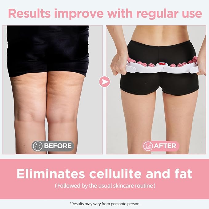 Cellulite Massage Tool Muscle Roller - Deep Fascia Massager & Dimpled Skin Remover for Legs, Thighs & Buttocks - Anti-Cellulite Roller, Smooth Skin, Pain Reliefs (Pink) - Bloomnest