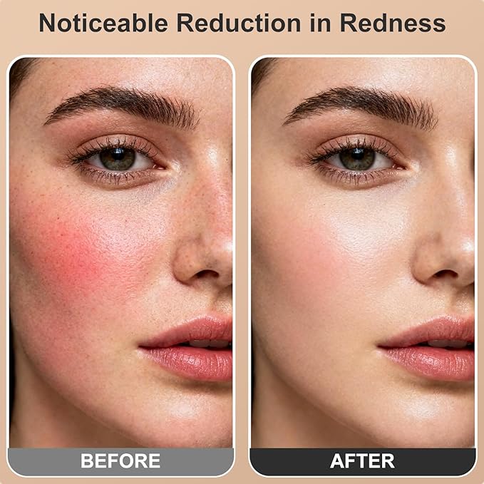Red Light Therapy for Face and Body, Dual 660nm & 850nm Near Infrared Red Light Therapy Panel with Adjustable Stand and Timer, 3 Modes and 6 Brightness Levels,Ideal Gift for Family & Friends (white) Ziptly