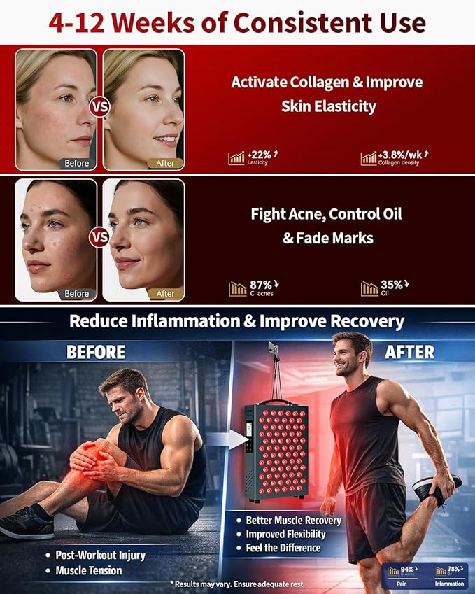 Lawind Red Light Therapy Panel for Face & Body, 660nm Red & 850nm Near Infrared Light Therapy, 72 High Power LEDs, 180mW/cm² High Irradiance LED Red Light Panel with Remote, Timer & Stand