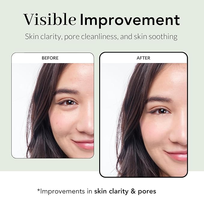 NOWATER Tea Tree Wrapping Mask, Skin Soothing care & Acne-prone Skin - Teatree & 6 Tropical Fruit Extracts, Calming Peel Off Mask, Korean Skincare for Face (2.4 Oz) - Bloomnest