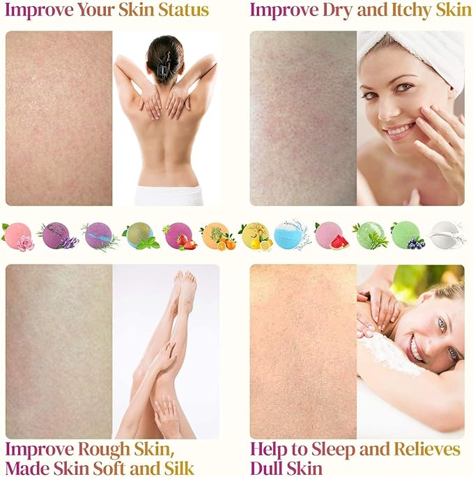 KIMHY Bath Bombs for Women, 12 PCS Bath Bombs for Girls Kids Toddlers Adults, Shea & Coco Butter Dry Skin Moisturize, Bath Bomb Kit for Birthday Halloween Christmas - Bloomnest