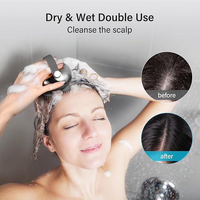 arboleaf Scalp Massager Rechargeable Head Massager Scalp Stress Relax, Waterproof Handheld Hair Scratcher with 8 Removable Massage Claws, Gift for Dad Mom arboleaf
