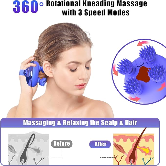 Scalp Massager Electric, Portable Scalp Massager Tool, Waterproof Head Massage Stress Relax, Hair Massagers with 3 Speed Modes & 8 Massage Claws Viuyougor