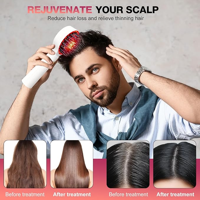 3 in 1 Scalp Massager Hair - 360° Hair Oil Applicator Electric Scalp Massager IPX7 Waterproof for Home & Travel (White) Bloomnest