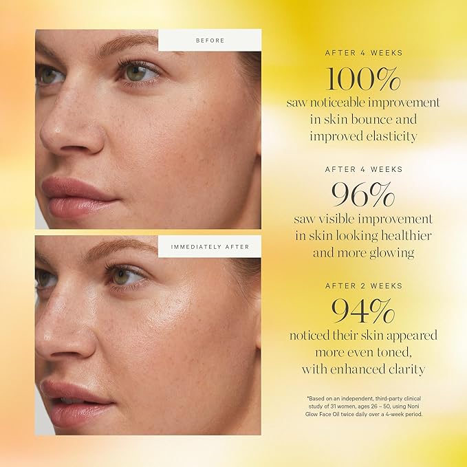 KORA Organics Noni Glow Hydrating Face Oil for Women with Rosehip, Gua Sha Oil, Certified Organic, Cruelty Free, 1.69 fl oz - Bloomnest