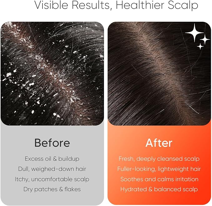 EKZ Sonic Vibrating Scalp Massager Shampoo Brush: Electric Silicone Hair Scrubber for Deep Scalp Clean, Dandruff Removal, Exfoliation, Stress Relief & Hair Growth –Suitable for Women, Men, Kids & Pets EKZ