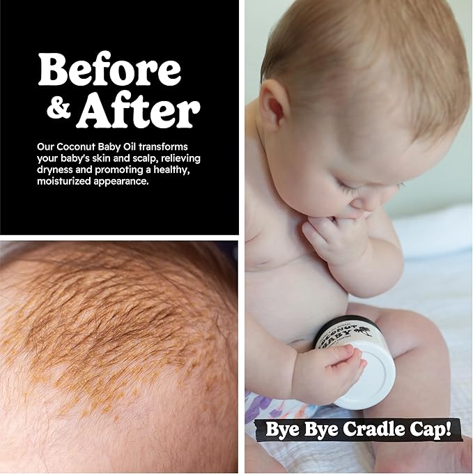 Coconut Baby Oil for Hair & Skin Care, Natural & Organic, Coconut Oil for Cradle Cap, Eczema, Infant Scalp Relief, Hair Oil for Curly Hair - Newborn Moisturizer for Sensitive Skin, Unscented - 2 fl oz - Bloomnest
