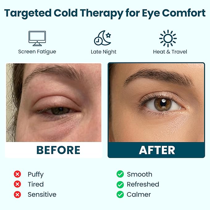 CHILL Cooling Eye Mask – Cold Eye Mask for Puffy Eyes, Cool Eye Compress for Sleep, Ice Eye Mask, Ice Pack for Eyes, Valentines Gifts for Her - Gifts for Women, Wife, Bridesmaids, Bachelorette Party