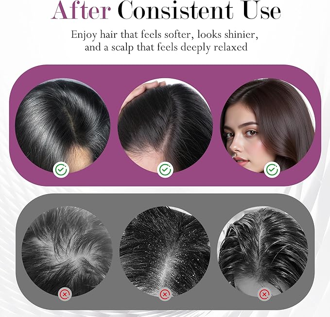 3-in-1 Rechargeable Scalp Massager Hair Growth Oil Applicator, Gentle Scratching & Kneading, IPX7 Waterproof, Electric Head Massage Tool for Home Spa, Portable Scalp Brush for All Hair Types Bloomnest