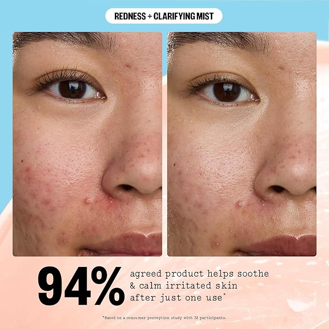PEACE OUT Redness + Clarifying Mist, Hypochlorous Acid Facial Spray for Acne-Prone Skin, Helps Calm Redness, Control Excess Oil, and Refresh Skin Over and Under Makeup, 3.3 fl oz - Bloomnest