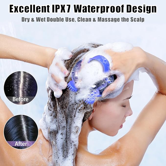 Scalp Massager Electric, Portable Scalp Massager Tool, Waterproof Head Massage Stress Relax, Hair Massagers with 3 Speed Modes & 8 Massage Claws Viuyougor