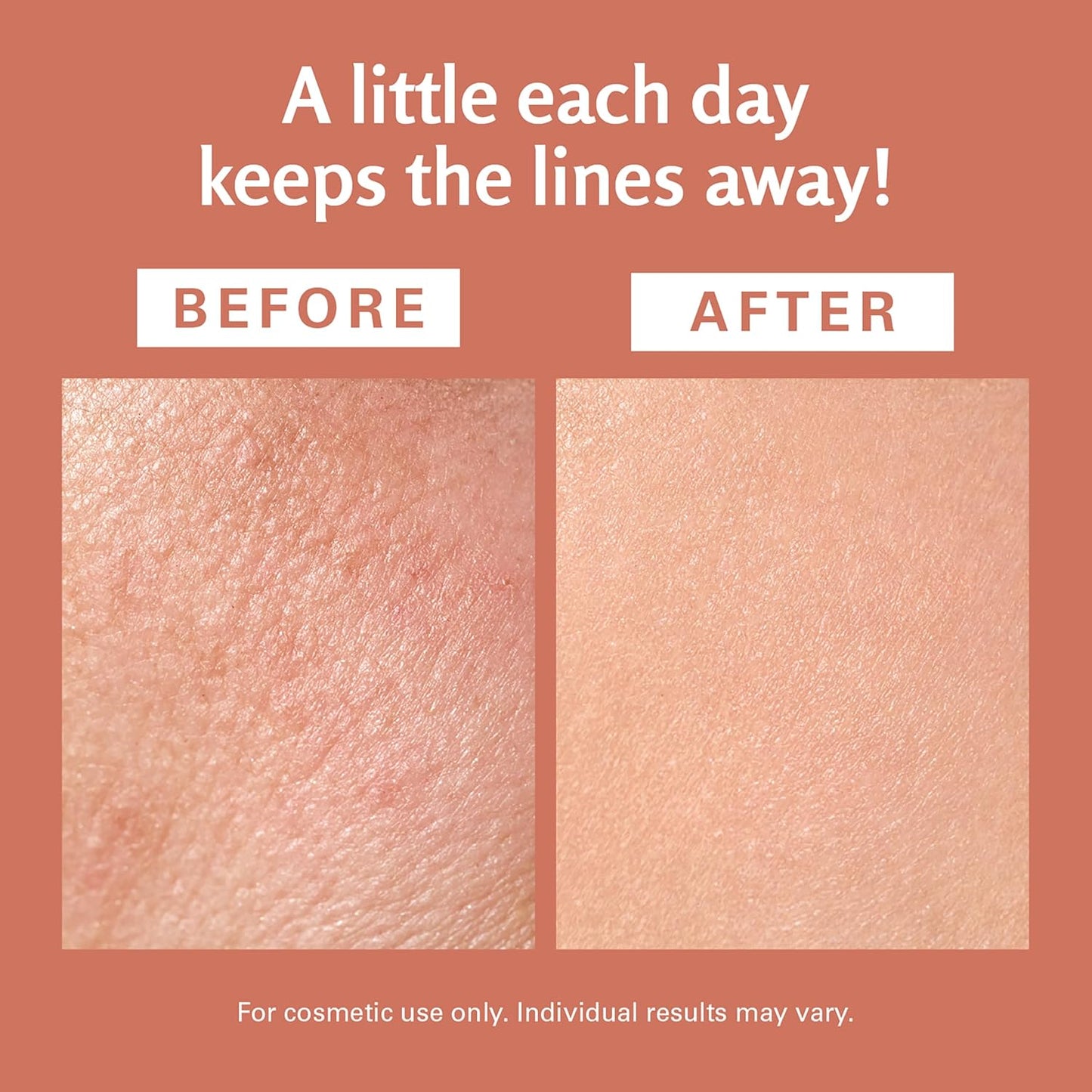 Frankincense Essential Massage Oil for Scars, Stretch Marks & Fine Lines, Firming, Hydrating, Smoothing & Calming Formula with Collagen, Stem Cells, Lavender & Grapefruit, 8 fl oz, by M3 Naturals