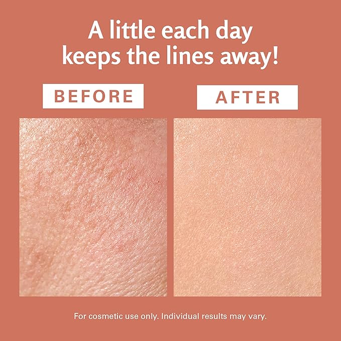 Frankincense Essential Massage Oil for Scars, Stretch Marks & Fine Lines, Firming, Hydrating, Smoothing & Calming Formula with Collagen, Stem Cells, Lavender & Grapefruit, 8 fl oz, by M3 Naturals - Bloomnest