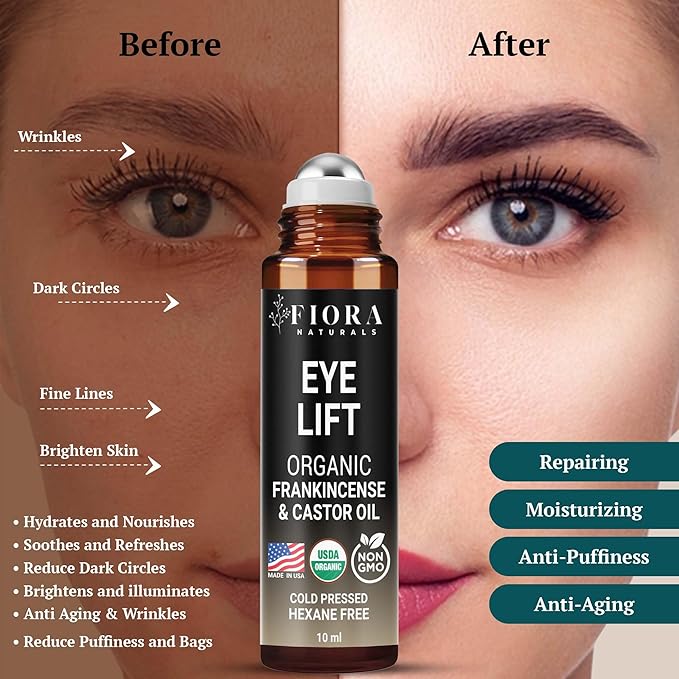 Organic Castor Oil and Frankincense Roll On – 100% Pure Hexane Free Eye Oil for Under Eye, Reduces Wrinkles, Dark Circles & Puffiness, Frankincense Essential Oil for Face Roller by Fiora Naturals - Bloomnest